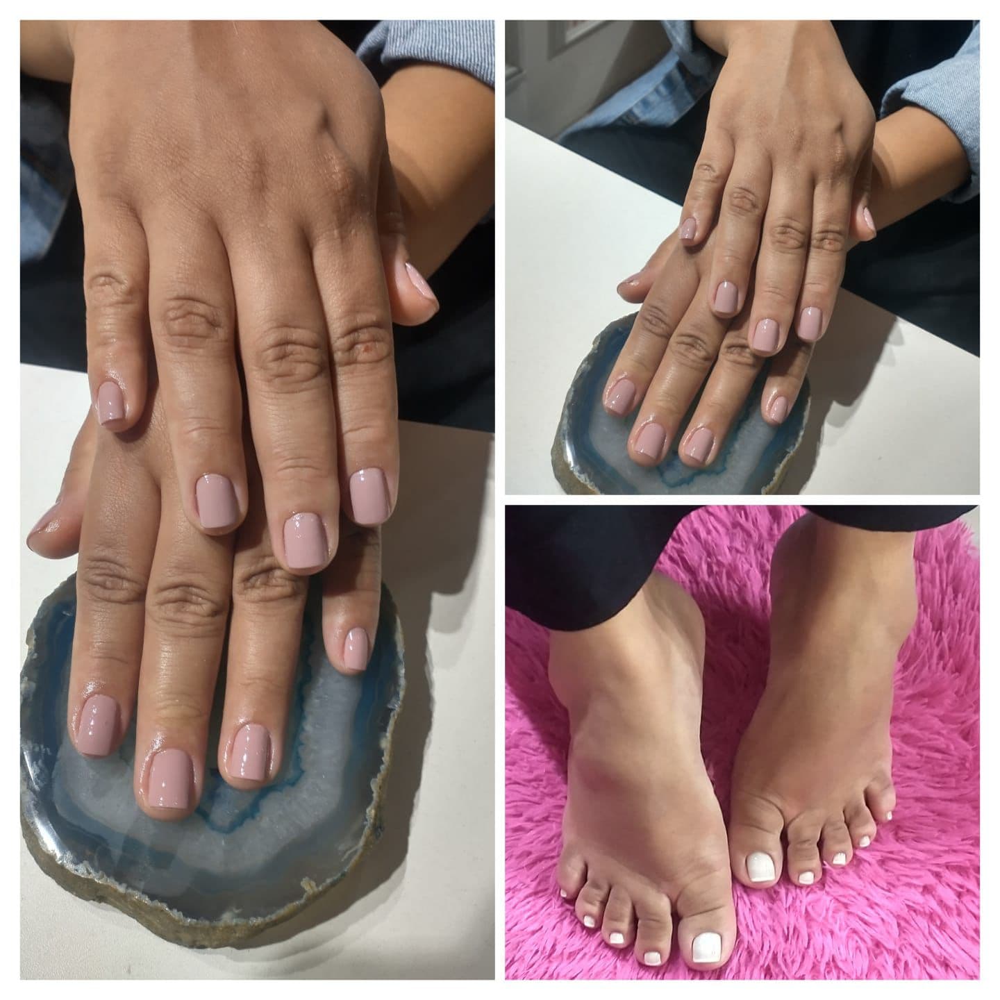 Unhas